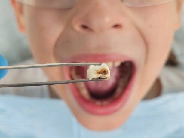 Best Emergency Cosmetic Dentistry (e.g., broken veneers) in Falls City, NE